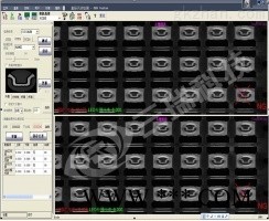 LED灯座缺胶脏污CCD视觉检测图1